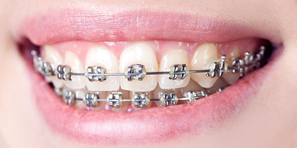 Эстетическая стоматология - художественная реставрация зубов